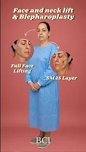 Face and neck lift and blepharoplasty