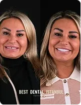 Two blonde women smiling side by side